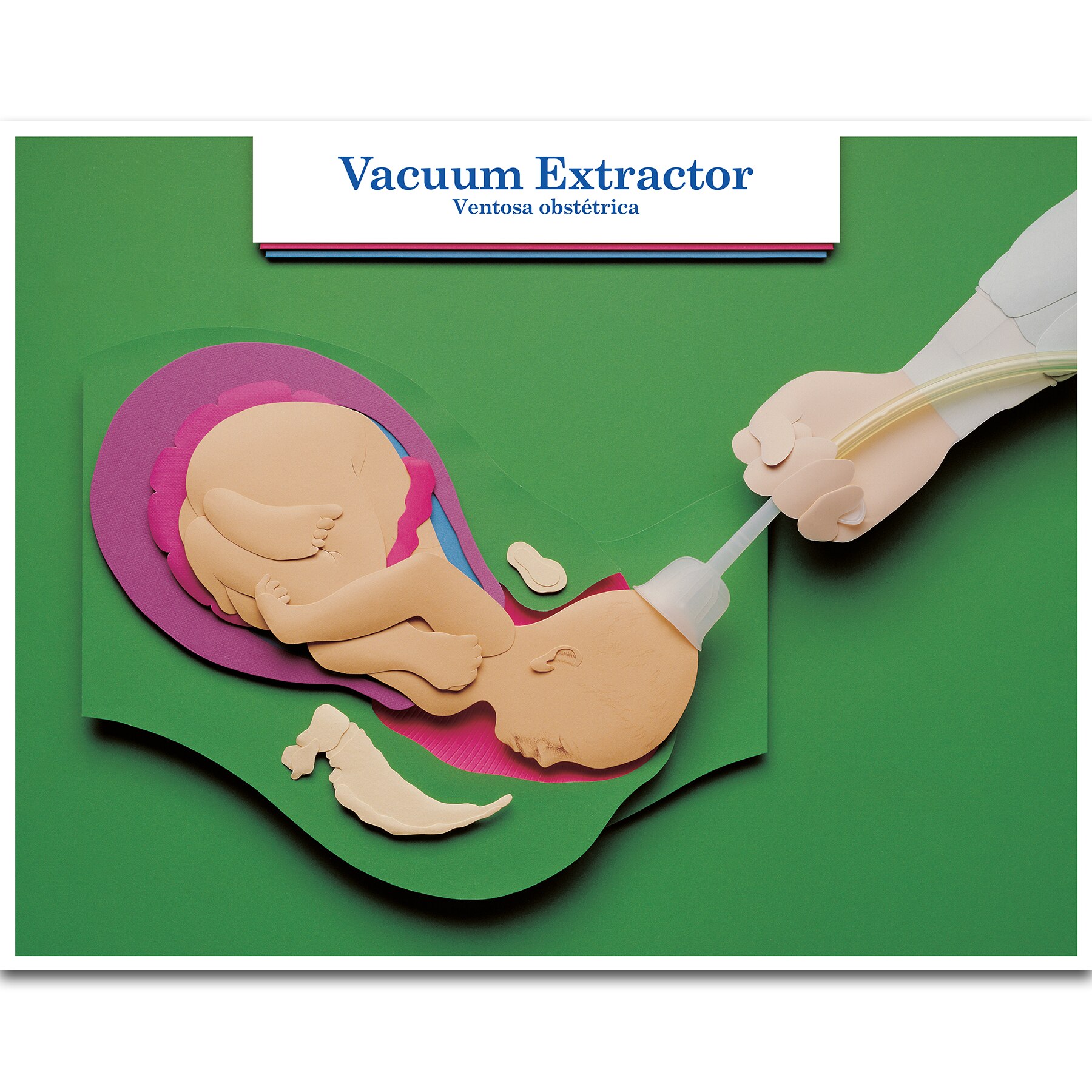 Childbirth Education Products Childbirth Graphics