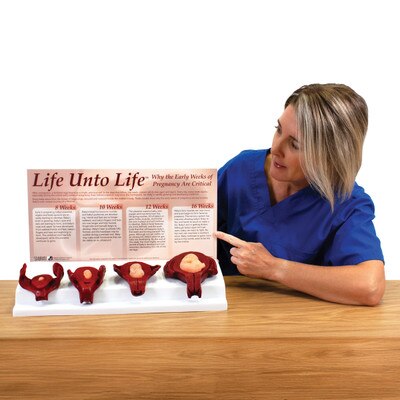 Life Unto Life: The Early Weeks of Pregnancy Display, health education fetal and uterus models, Childbirth Graphics, 22773