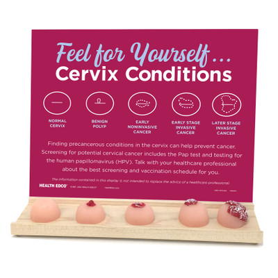Feel for Yourself: Cervix Conditions Display for health education by Health Edco with models of cervical conditions, 26805