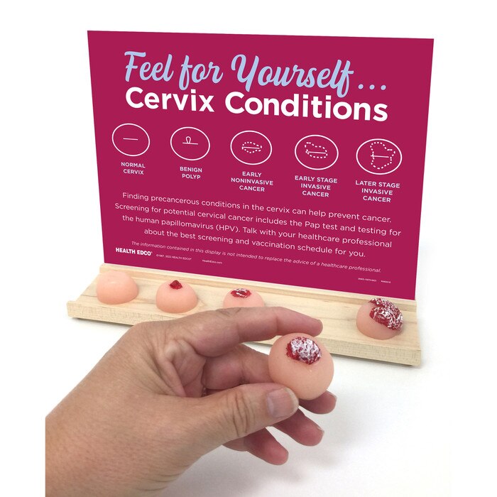 Feel For Yourself Cervix Conditions Display Health Edco
