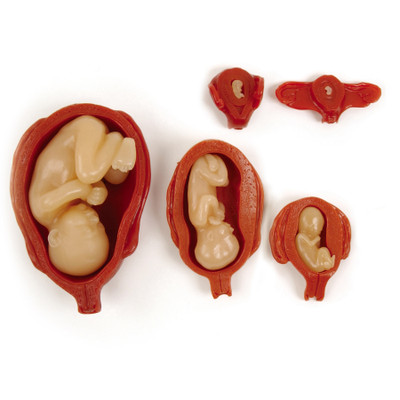 Uterus Fetus Model Set, lifelike, fetus removable, 5 models, 8 weeks, 10 weeks, 16 weeks, 22 weeks, 40 weeks, fetal position and development demonstration, Health Edco, 27007