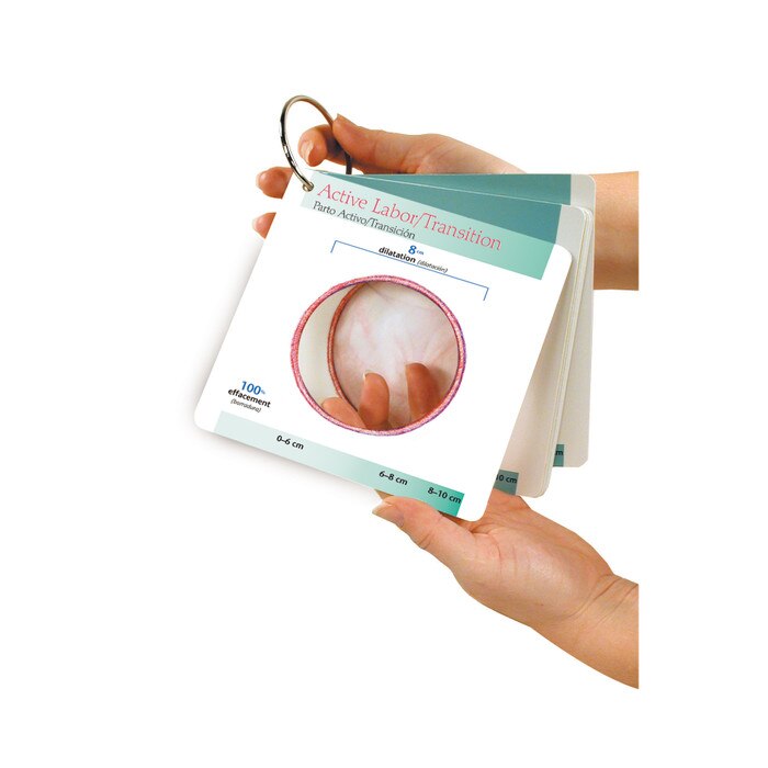 Labor Progress Pocket Guide, active labor transition illustrated dilation cut outt 8 centimeters, Childbirth Graphics, 38826
