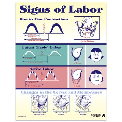 Signs of Labor Tear Pad by Childbirth Graphics for childbirth education and teaching about labor and cervical changes, 52567