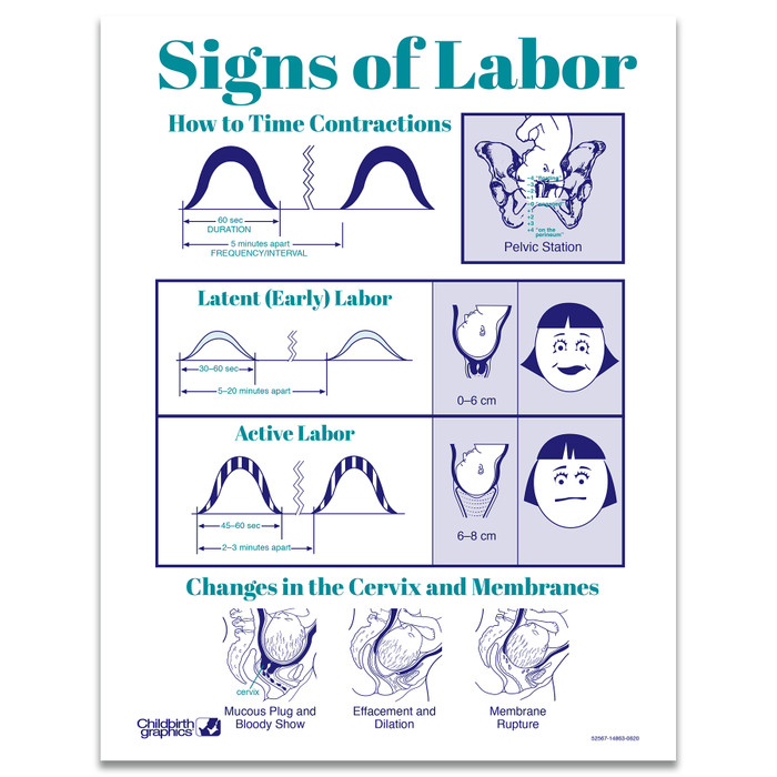 Signs of Labor Tear Pad by Childbirth Graphics for childbirth education and teaching about labor and cervical changes, 52567