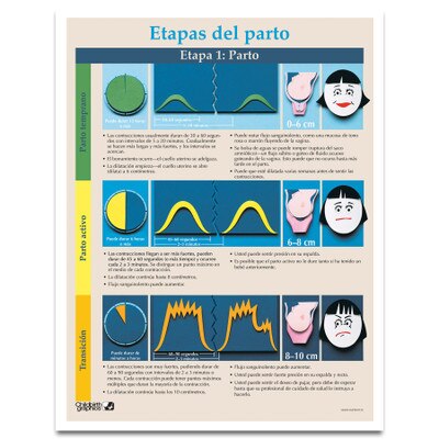 Stages of Labor Tear Pad in Spanish for childbirth education from Childbirth Graphics, childbirth teaching materials, 52604