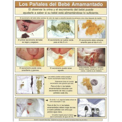 Diapers of the Breastfed Baby full color photo tear pad Spanish, colors of breastfed stool, Childbirth Graphics 52757