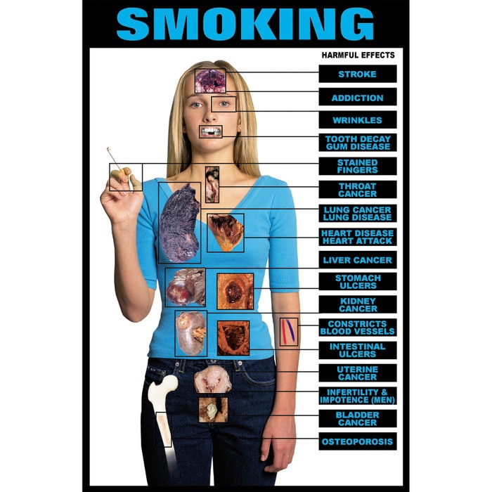 Educational Harmful Effects Of Smoking Chart Health Edco