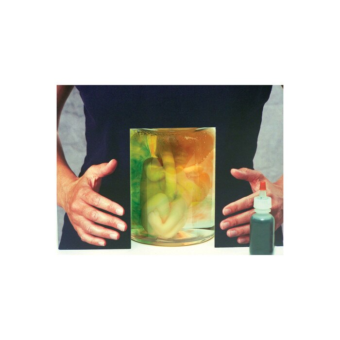 What Mommy Does Baby Does Display, substance abuse during pregnancy demonstration model, Childbirth Graphics, 78745