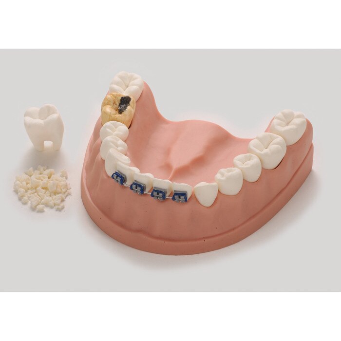 Dental Teeth Model For Health Education Health Edco