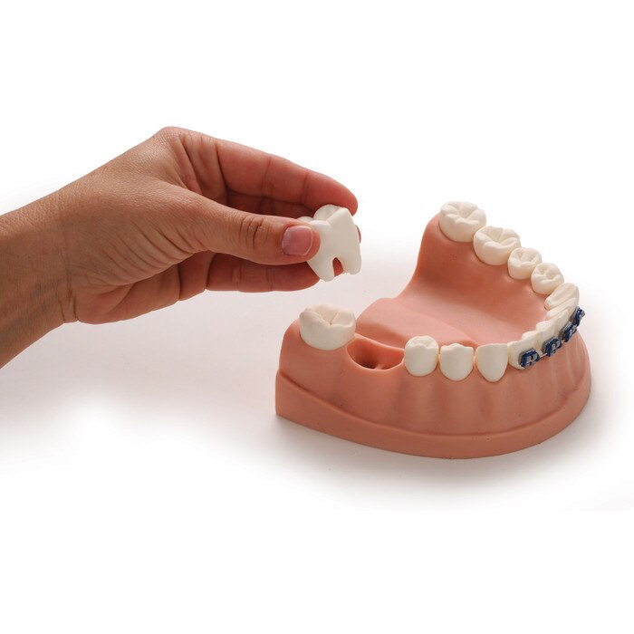 Dental Teeth Model For Health Education Health Edco