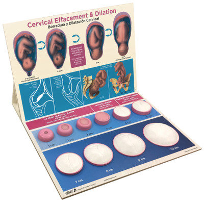 Cervical Effacement & Dilation Model for childbirth education, Childbirth Graphics labor and birth teaching materials, 79700
