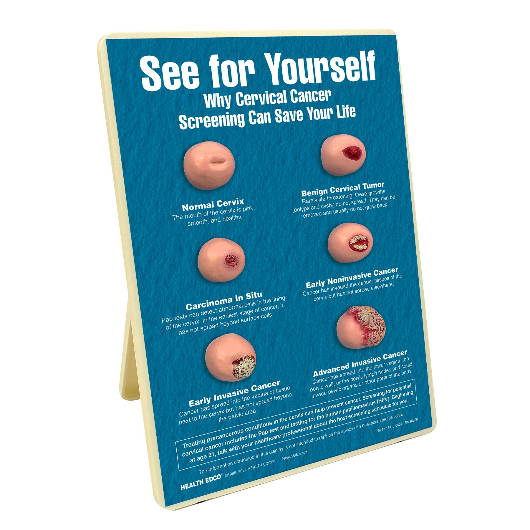 Bypass The Wait:  Quick Access To Your Patientplus Pap - o2pcl33