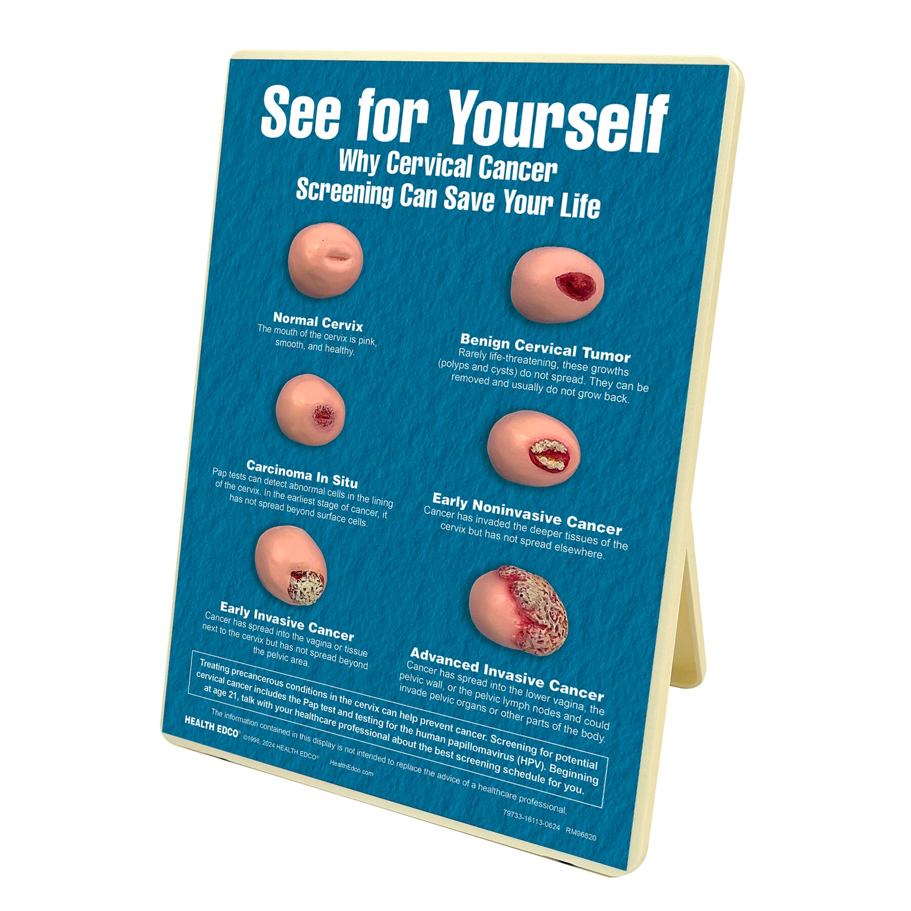 Pap Tests Easel Display For Health Education Health Edco