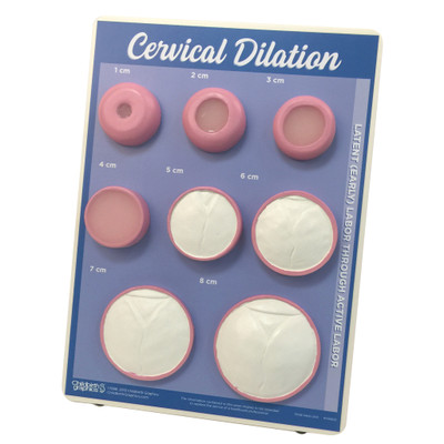 Cervical Dilation Easel Display labor and birth education resource from Childbirth Graphics with cervix models, 79738
