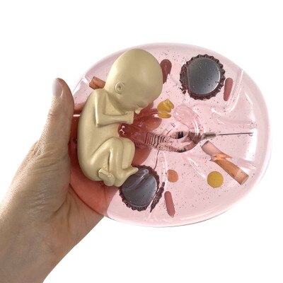 What Mommy Does, Baby Does Model, pregnancy education model showing dangers of substance abuse, Childbirth Graphics, 79809