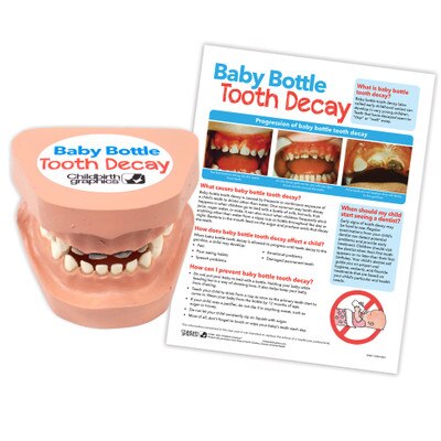 Baby Bottle Tooth Decay Model Set, toddler tooth decay model with parenting education handout, Childbirth Graphics, 79865