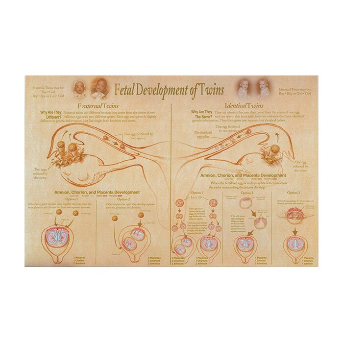 Post Twins Chart, Fetal Development of Twins illustrated fraternal & identical development, Childbifrth Graphics, 89643