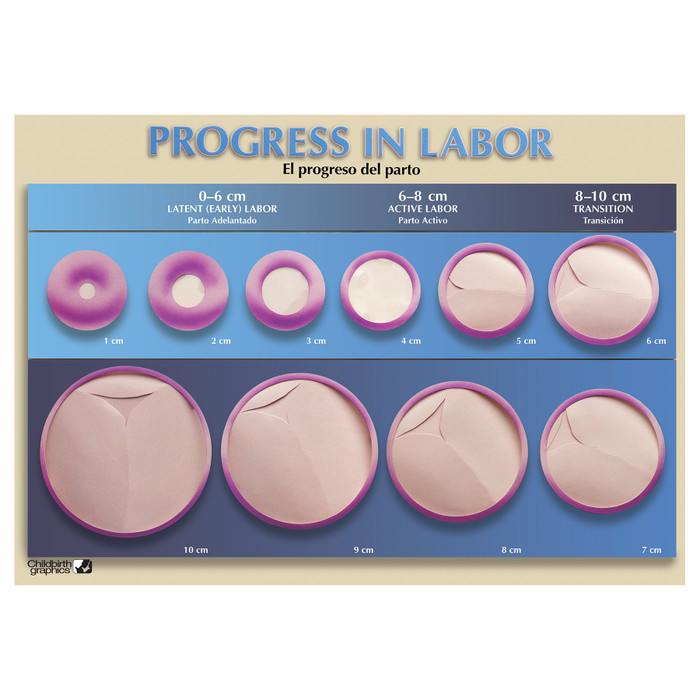Progress in Labor Chart for childbirth education by Childbirth Graphics showing centimeters of cervical dilation, 90617
