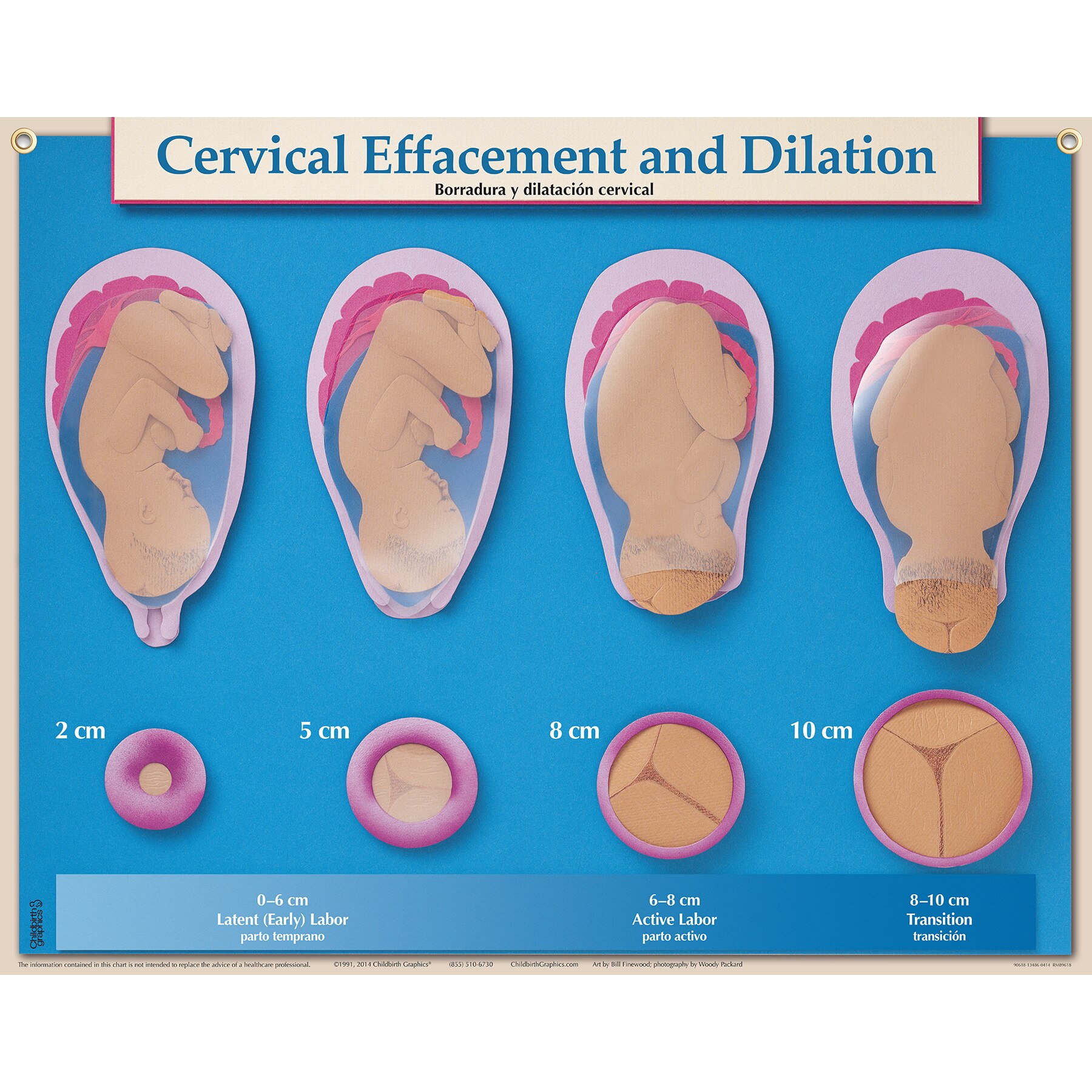Cervical Effacement Dilation Chart Childbirth Graphics