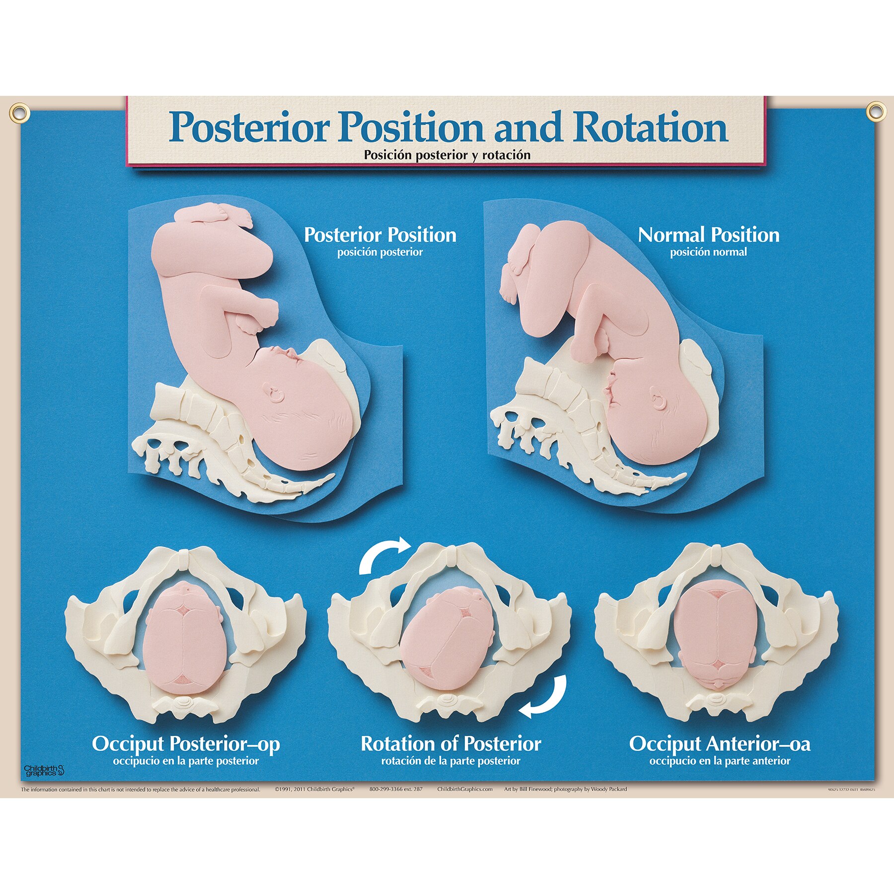 Posterior Position Rotation Chart Childbirth Graphics