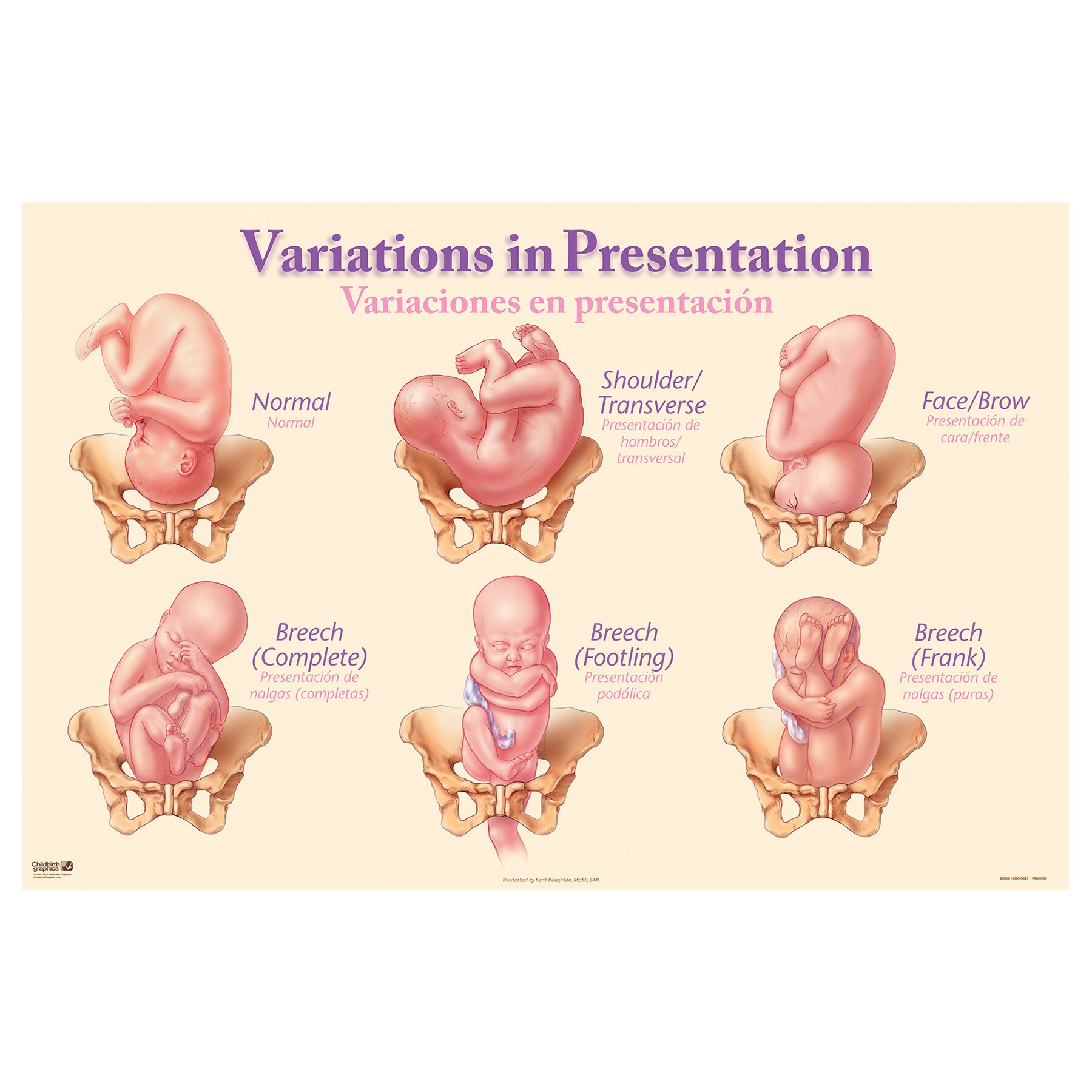 Abdominal Palpation Model Set Childbirth Graphics