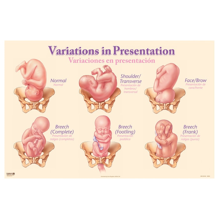 types of presentation during pregnancy