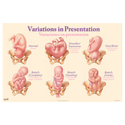 Variations in Presentation Chart depicting different fetal birth presentations, Childbirth Graphics educational chart, 90836