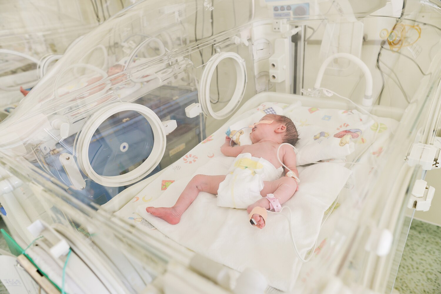 baby in neonatal intensive care unit (NICU)