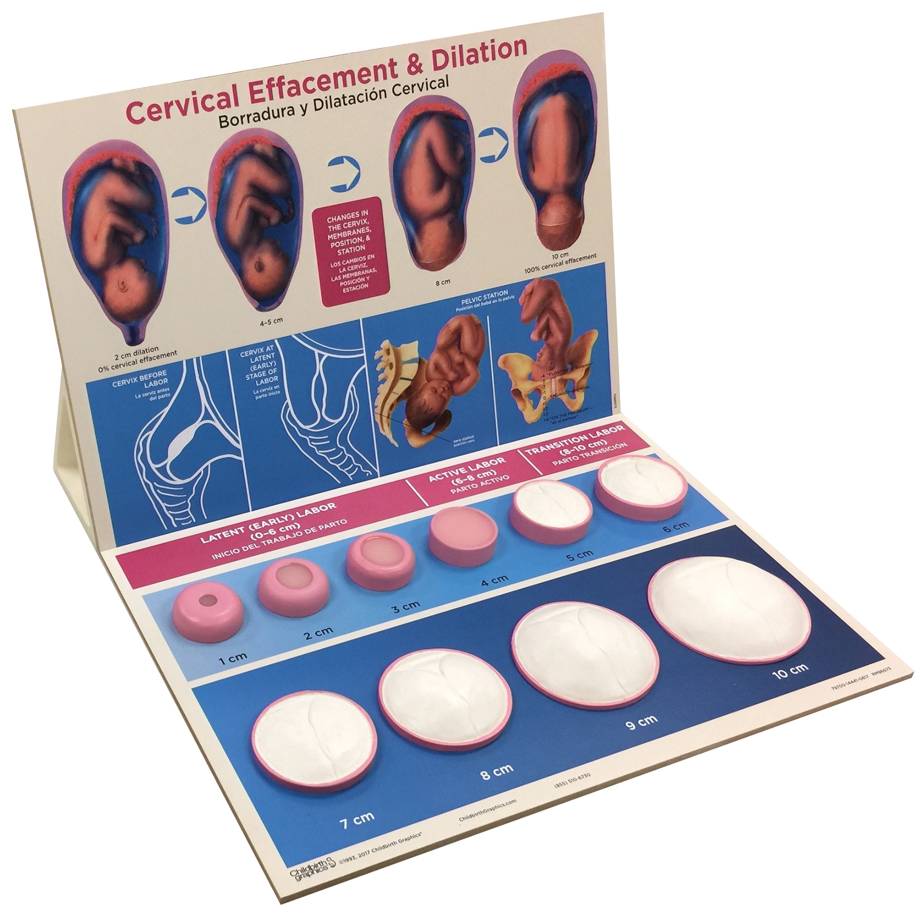 Cervical Effacement and Dilation Model for childbirth education from Childbirth Graphics