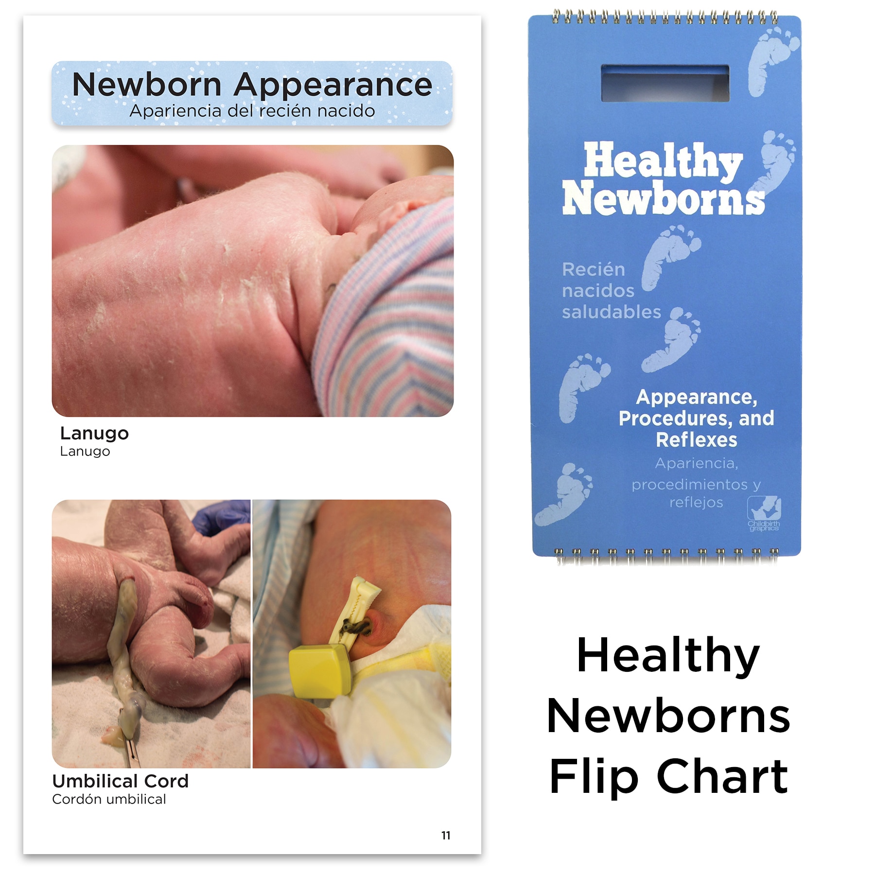 Healthy Newborns Flip Chart, Bilingual, Childbirth Graphics 43303