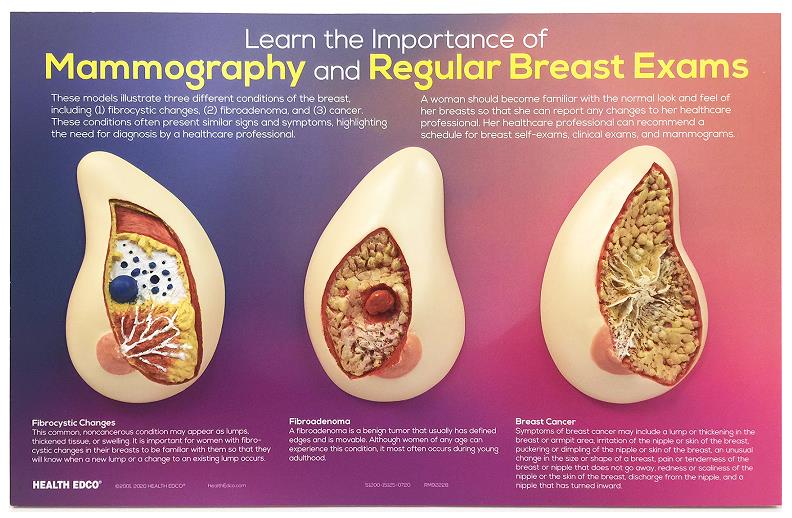 Learn the Importance of Mammography breast health education display from Health Edco