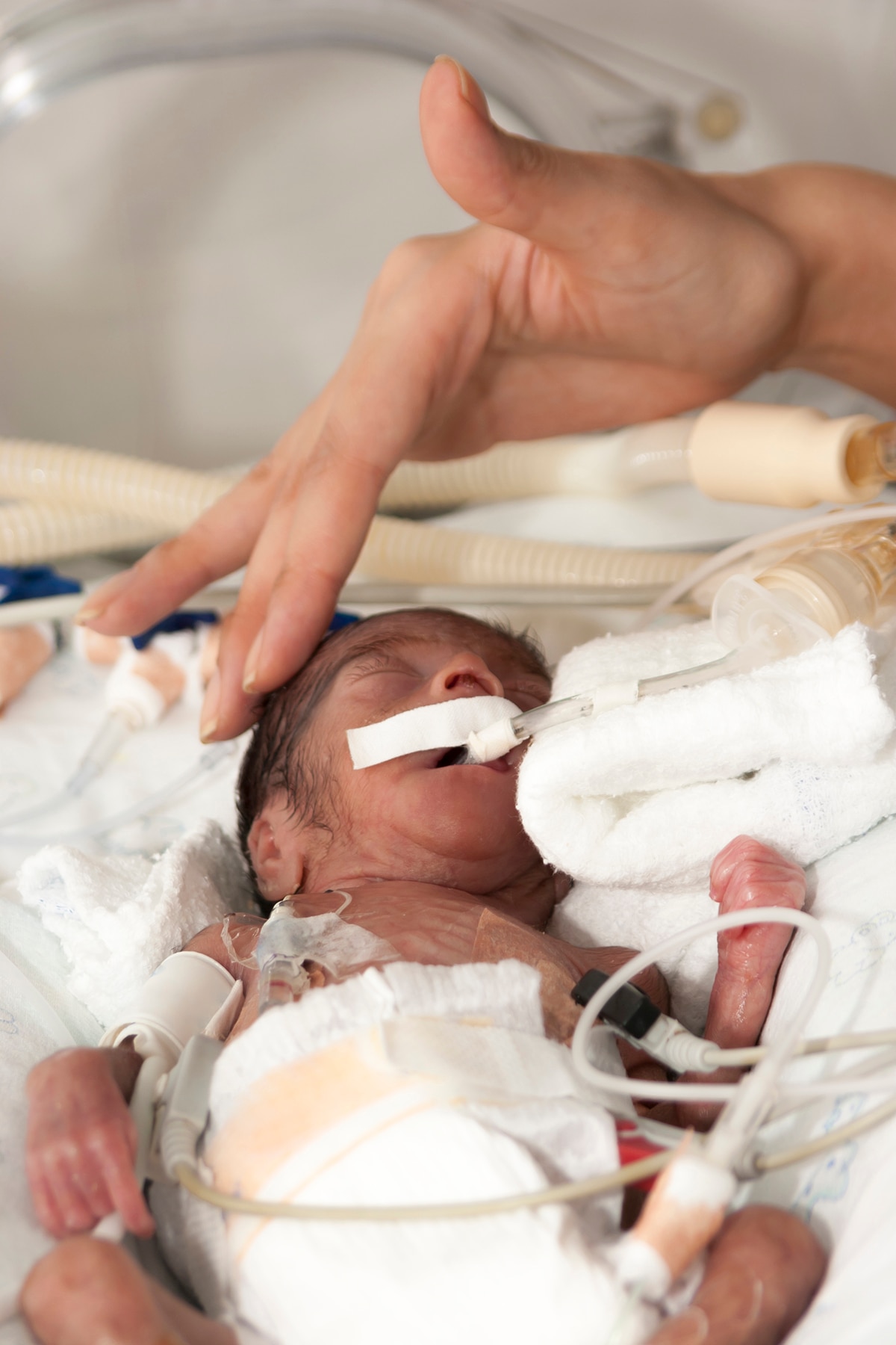 Premature baby in NICU being touched by a nurse