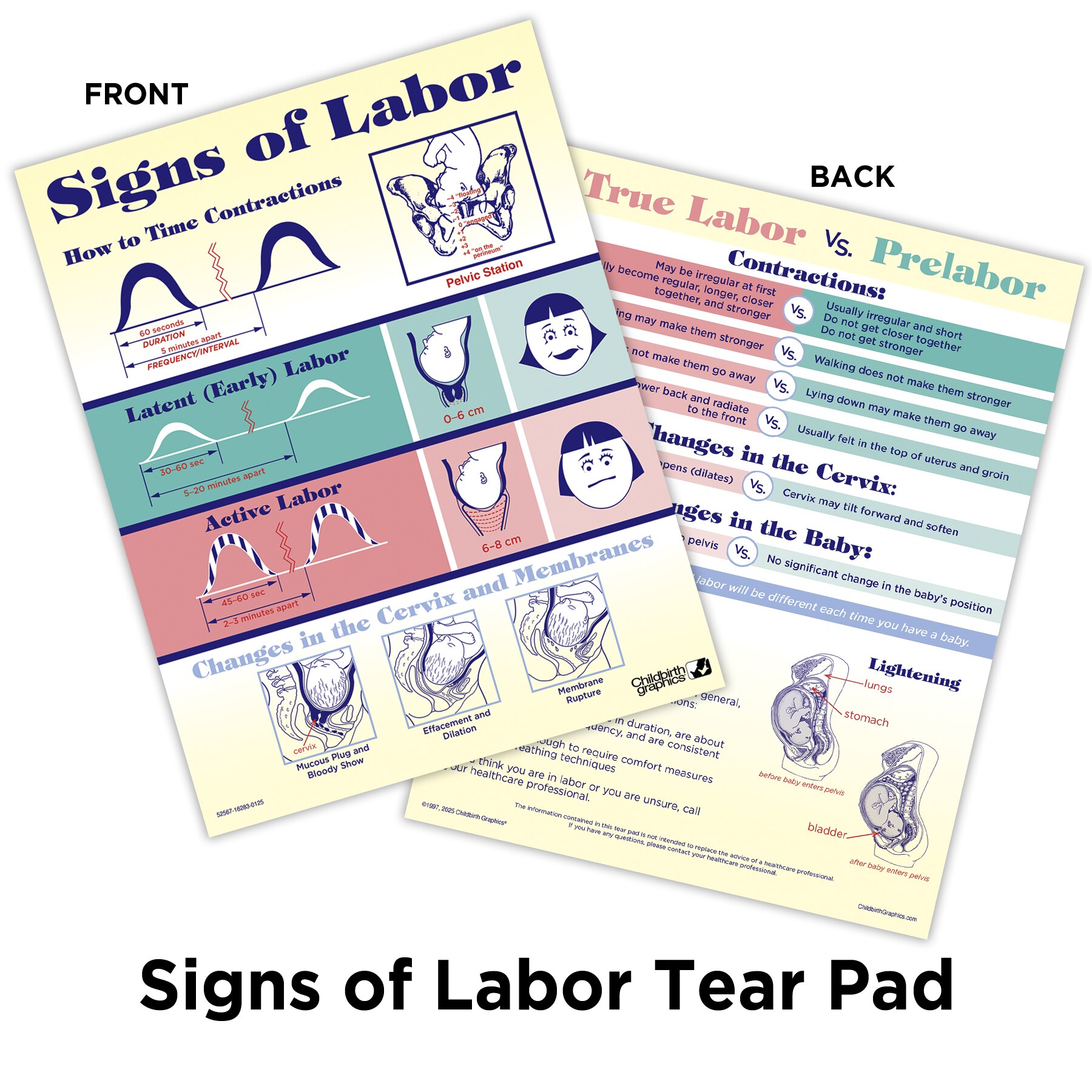Signs of Labor Tear Pad, childbirth education tear pad to explain childbirth labor signs, Childbirth Graphics, 52567