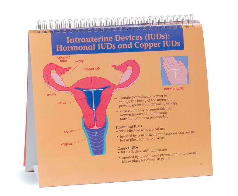 Understanding Birth Control Flip Chart from Childbirth Graphics