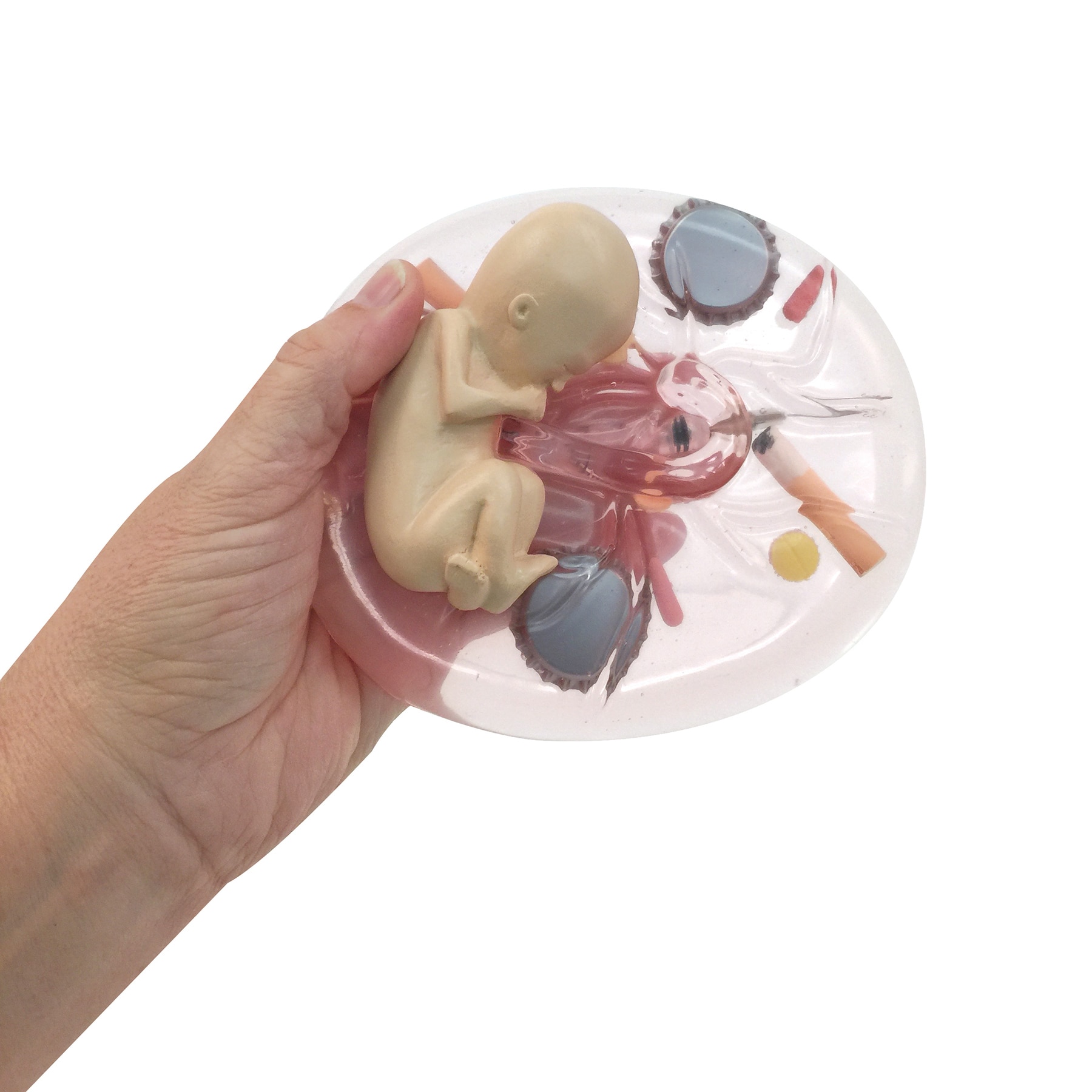 What Mommy Does, Baby Does Substance Abuse in Pregnancy Educational Model